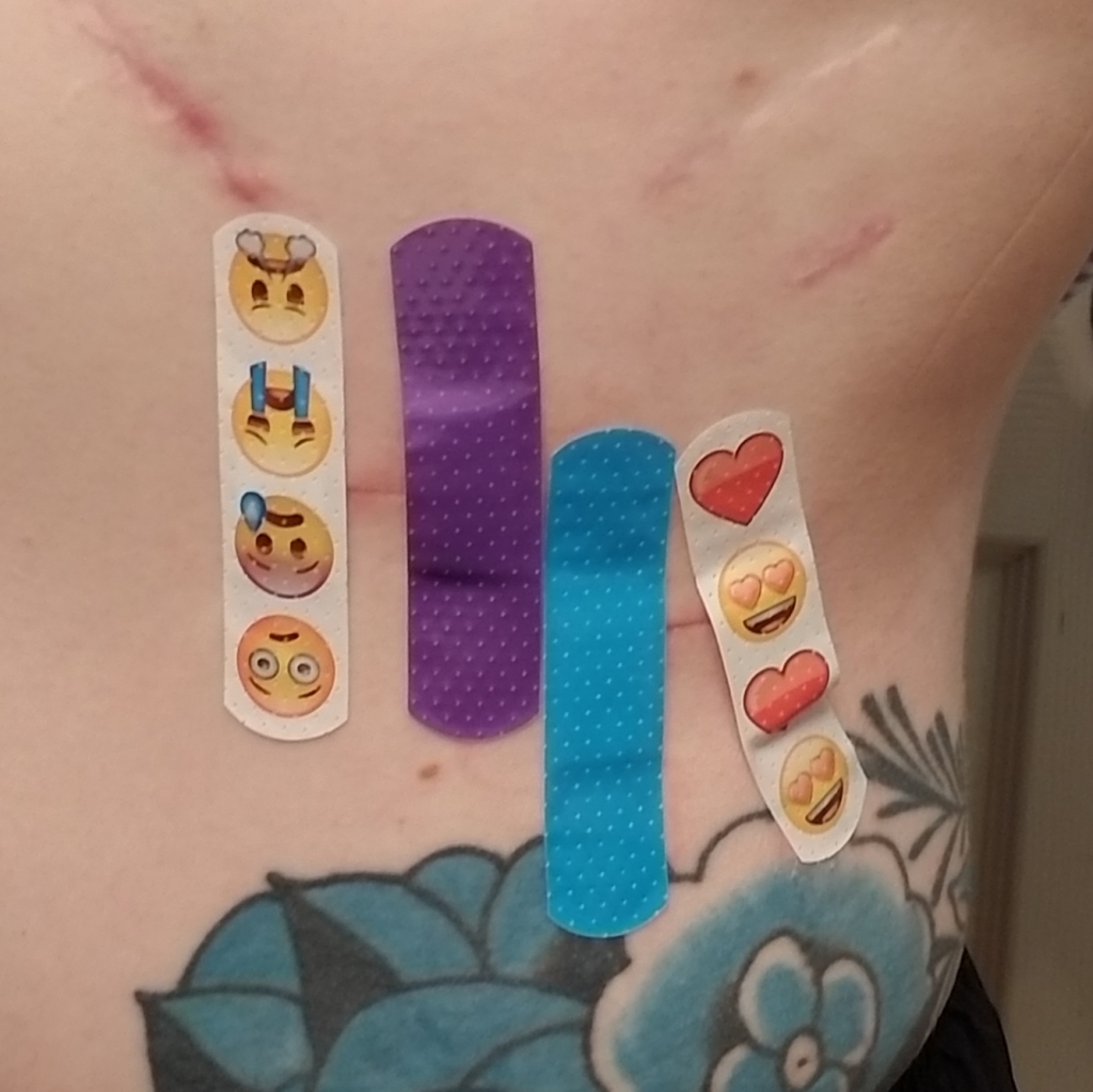 Seven Scars & My 10th Procedure